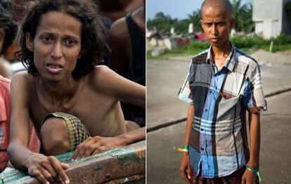 Fotografías de Yusuf, un joven rohingya de 22 años, antes y después de ser rescatado en alta mar y llegar a costas de Tailandia.