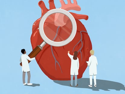 Las mujeres también padecen enfermedades de corazón (pero se les diagnostica y trata menos)
