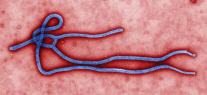 Micrografía del virus Ébola.