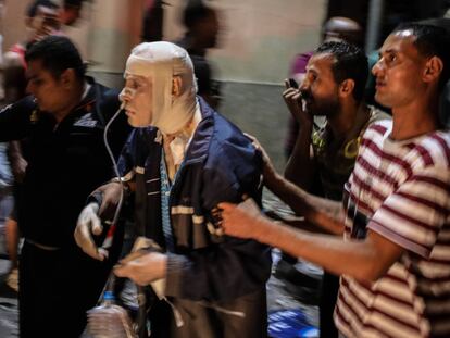 Un herido tras la explosión en El Cairo, Egipto.