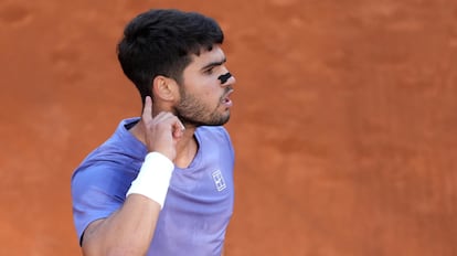 The nasal strips used by athletes like Carlos Alcaraz and that help you breathe better when sleeping, in everyday life and when playing sports | Lifestyle | Showcase