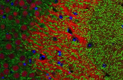 Detección de la proteína (en verde) del gen `Crtc1´ en neuronas del hipocampo del ratón con alzhéimer.