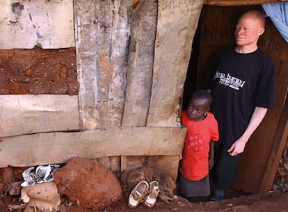 "Muzungu": así llaman sus vecinos a Wycliffe Ambeyi, este keniano de 33 años que vive en Kibera, Nairobi, la mayor concentración de chabolas de África. Amebeyi es albino. En la imagen posa junto a una de sus dos hijas. "Mi familia es el motor", asegura este hombre enfermo de sida, que vive con el miedo a las creencias sobre los albinos que provocan tantos crímenes en la vecina Tanzania.