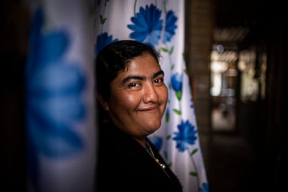 Valdeflores, Oaxaca. Ceci tiene 37 años y su primera operación de labio fue a los 40 días de nacer. A partir de ahí, ha tenido unas seis operaciones más de labio y paladar siendo ella un bebé, y cuatro más que recuerde. De todas, solo la primera fue gratuita.