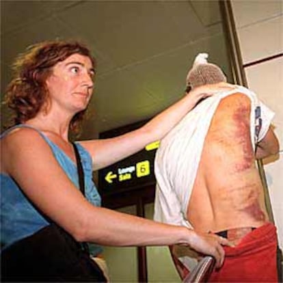 Una mujer muestra las heridas de uno de los jóvenes detenidos en Génova.