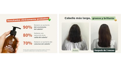El aceite de romero para el pelo​ es la mejor solución anticaída.