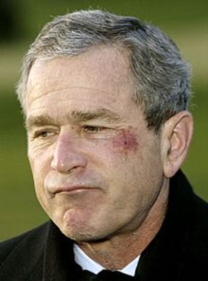 Bush muestra las heridas en su rostro.