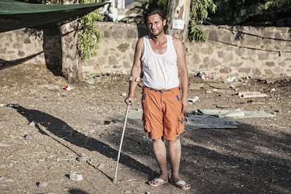 Imad, 35 años, trabajaba como operador de mercancías en Alepo (Siria) hasta que un disparo de un francotirador le fracturó la pelvis y el fémur. Tras desembarcar en Lesbos, espera poder operarse en Europa para nivelar sus dos piernas. 