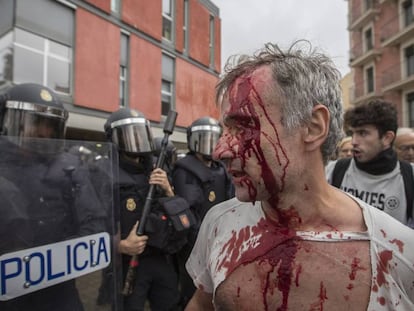 Un herido en las cargas en la escuela Mediterránea de Barcelona el 1-O.