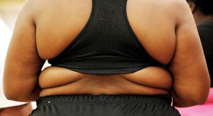 Una mujer con obesidad.