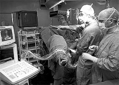 Franco Luniani y Fernando Gómez Sancha operan un cáncer de próstata con criocirugía.