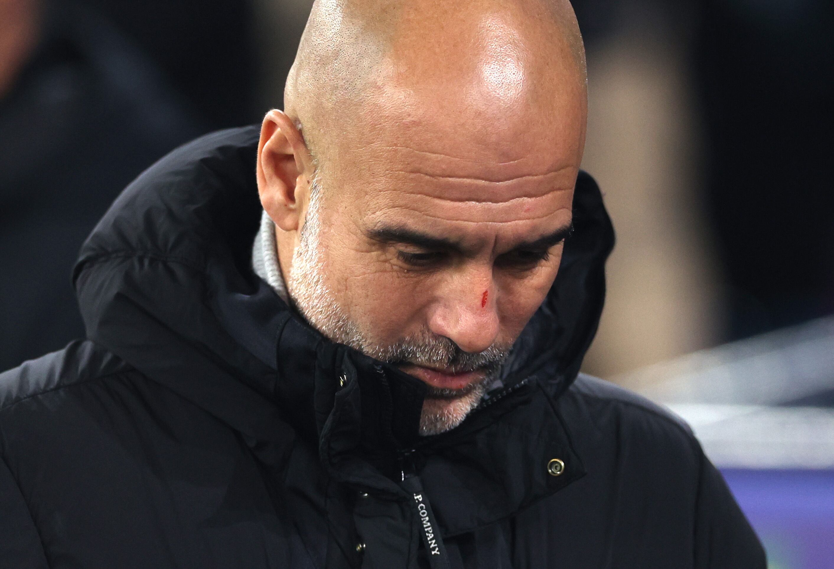 La explicación de Guardiola a la polémica de sus arañazos en la cara tras el partido de la Champions