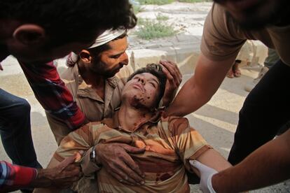 Un hombre sirio recibe tratamiento en la ciudad fronteriza siria de Tal Abyad, que fue masacrada por las fuerzas respaldadas por Turquía.