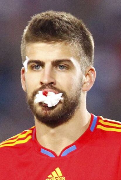 Piqué tras su golpe en la boca.