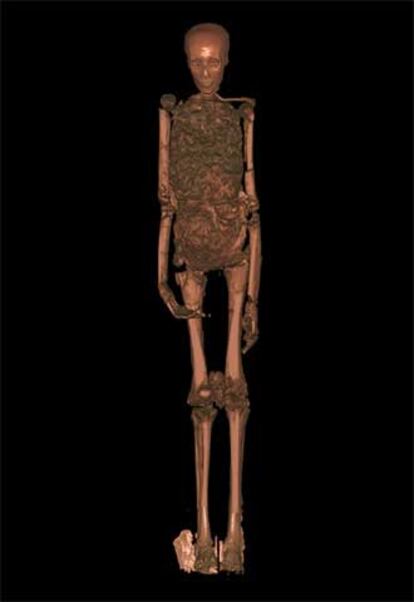 Escáner de la momia de Tutankamón.