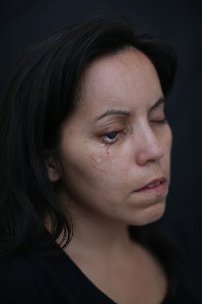 Retrato de Marlen Morales (33), operaria de producción de una multitienda nacional y madre soltera de tres hijos, que perdió un ojo al recibir el impacto de un perdigón durante las protestas en Chile cuando salió a caminar. Es una de las imágenes de Luis Sergio, finalista de los Premios Luis Valtueña.