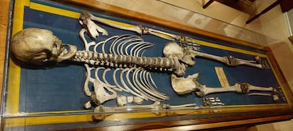 Agustín Luengo’s skeleton, “The Extremaduran Giant”. National Museum of Anthropology in Madrid.