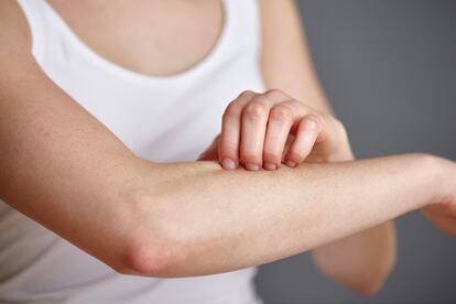 Cropped shot of young woman scratching her forearm with fingers