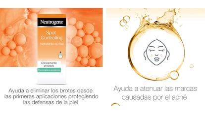 Esta crema hidratante para el acné acaba con los granos y previene de futuros brotes.