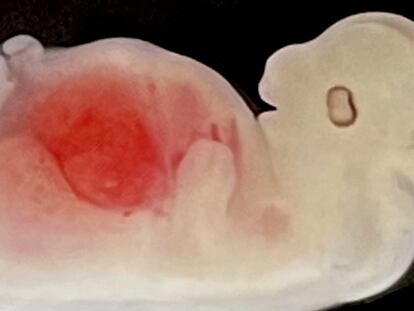 Un embrión porcino de 28 días, con un esbozo de riñón humano. Foto cedida por GIBH.