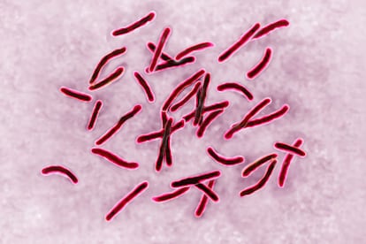 El bacilo 'Mycobacterium tuberculosis' causante de la tuberculosis, en una imagen tomada con un microscopio.