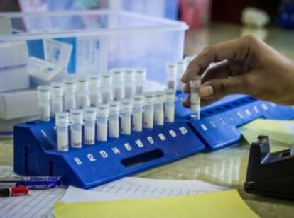 En el laboratorio de Kampong Cham el personal de Médicos Sin Fronteras recoge y analiza el esputo de los pacientes y puede detectar si es positivo en el mismo día de la recogida de las muestras.