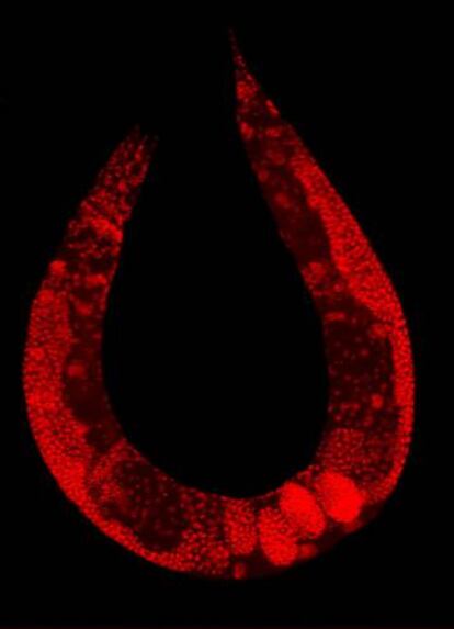 Un 'Caenorhabditis elegans' del tipo silvestre, iluminado para observar los núcleos de sus células.