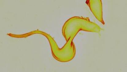 Imagen por microscop&iacute;a electr&oacute;nica de barrido del tripanosoma que causa la enfermedad del sue&ntilde;o.