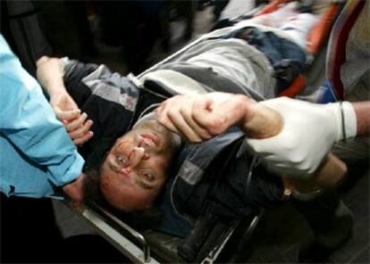 Ahmed Jadallah, fotografo de Reuters herido en la ofensiva, es evacuado a un hospital.