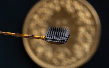 A close-up view of the electrodes that were implanted in the patient.