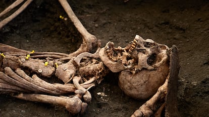 Detalle de los dientes de oro y botones de uno de los diez cuerpos encontrados en la fosa 17 del Barranco de Viznar, Granada.