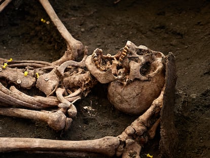 Detalle de los dientes de oro y botones de uno de los diez cuerpos encontrados en la fosa 17 del Barranco de Viznar, Granada.
