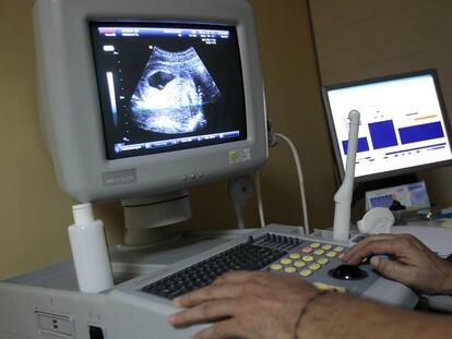 Un especialista realiza una ecografía en la clínica Dator de Madrid. 