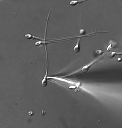 Experimento en el que se instalan electrodos en los espermatozoides, visto al microscopio.