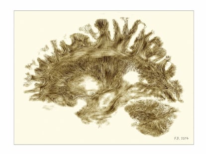 Dibujo a partir de la resonancia magnética de un cerebro humano adulto.