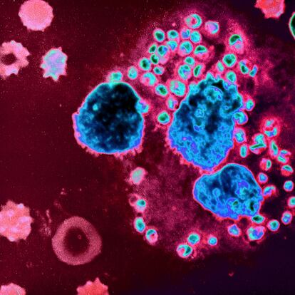 La leishmaniasis es una dolencia parasitaria transmitida por la picadura de un mosquito y que pertenece al grupo de enfermedades tropicales desatendidas reconocidas por la OMS.