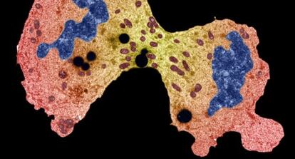 Célula cancerígena dividiéndose.