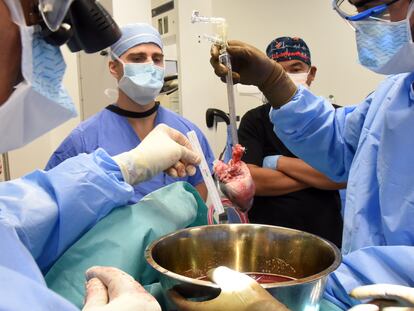 Surgeons prepare for a pig heart transplant into Lawrence Faucette at the school's hospital in Baltimore, Md., in September 2023.