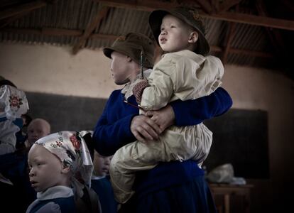 Dos niños con albinismo en la Mwisenge Primary School, en Musoma, Tanzania.
