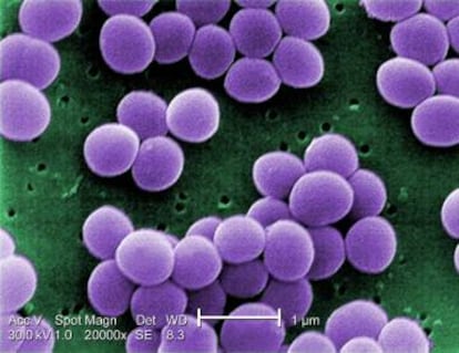 ‘Staphylococcus aureus’, one of the most common types of skin bacteria.