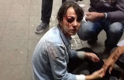 La periodista Giuliana Vallone, herida en la protesta.