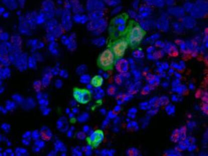 En verd, el nou tipus de cèl·lula mare, desenvolupant-se dins d'un embrió de ratolí.