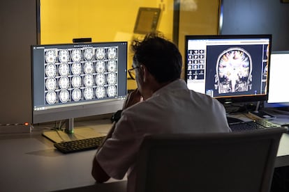 Alzhéimer investigación