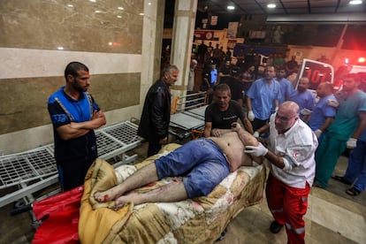 Un herido por los bombardeos israelíes era trasladado al hospital Nasser de Jan Yunis, este domingo.