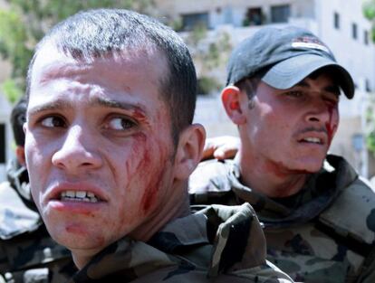 Dos de los soldados sirios heridos en una explosión cuando escoltaban un convoy de la ONU.