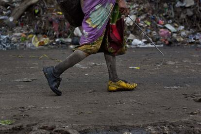 Una mujer que recoge materiales reciclables en un vertedero en Gauhati.