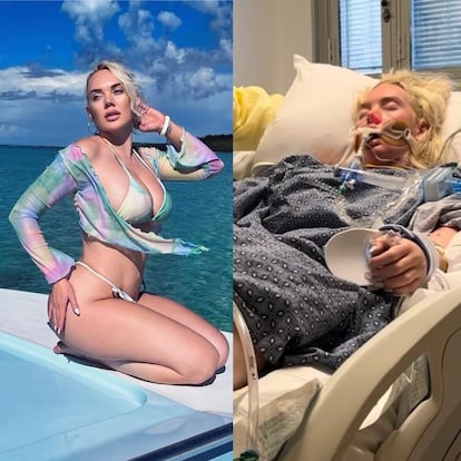 A la izquierda, Jennifer Barlow de vacaciones en las costas de Bahamas, y a la derecha, la modelo internada en un hospital en Estados Unidos, en una composición compartida en sus redes sociales.