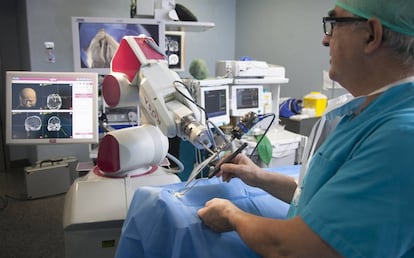 El neurocirujano Rafael García de Sola, con el robot Rosa.