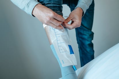 Un hombre se coloca una bolsa de recogida de orina en una pierna.