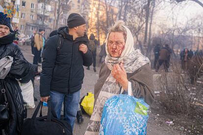 Una mujer herida camina durante la evacuación de un bloque de viviendas en Kiev. El Papa denunció, en referencia a la invasión y posterior guerra en Ucrania, que "la Humanidad se ve amenazada por un perverso abuso del poder" que está condenando "a personas indefensas a una violencia brutal".